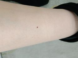 体验前-JS医疗美容