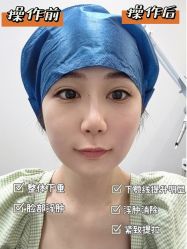 -针美汇欧邦医疗美容