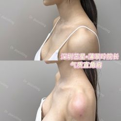 -深圳艺星医疗美容医院