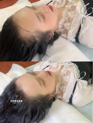 点击看大图 -西施无菌半永久纹绣眉眼影唇轻增发纹发际线