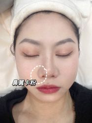 -SKIN79皮肤管理中心