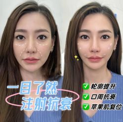 -蚌埠国色医疗美容医院•眼鼻整形