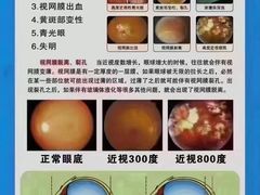 -宝视达眼镜(公园道店)