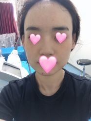 -八大处整形