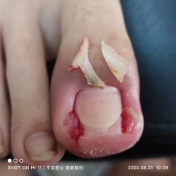 点击看大图 -爱足康修脚·甲沟炎·艾灸养生馆