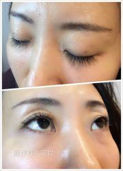 睫毛嫁接-光SPA科技美肤