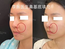 -北京米扬丽格医疗美容·联合丽格鼻整形中心