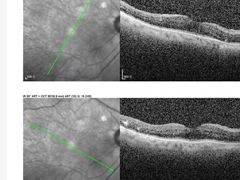 -首都医科大学附属北京同仁医院(西区)