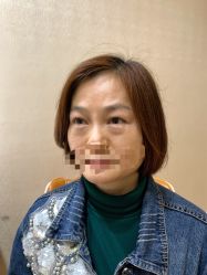 -天津健丽·去眼袋医疗美容机构