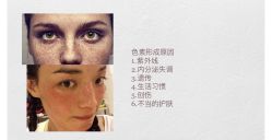 -安吉拉青春化管理中心