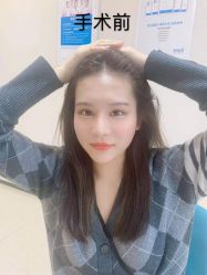 体验前-雍禾植发全国连锁