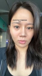 体验前-深圳医恒美医疗美容