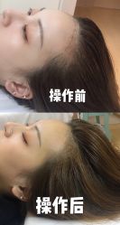-久匠·纹眉纹绣半永久