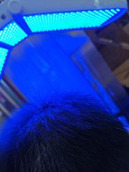 -碧莲盛·不剃发植发