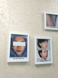 -成都西区医院整形美容