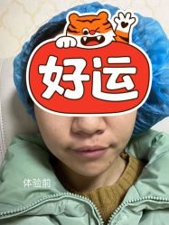 体验前-南京医科大学友谊整形外科医院