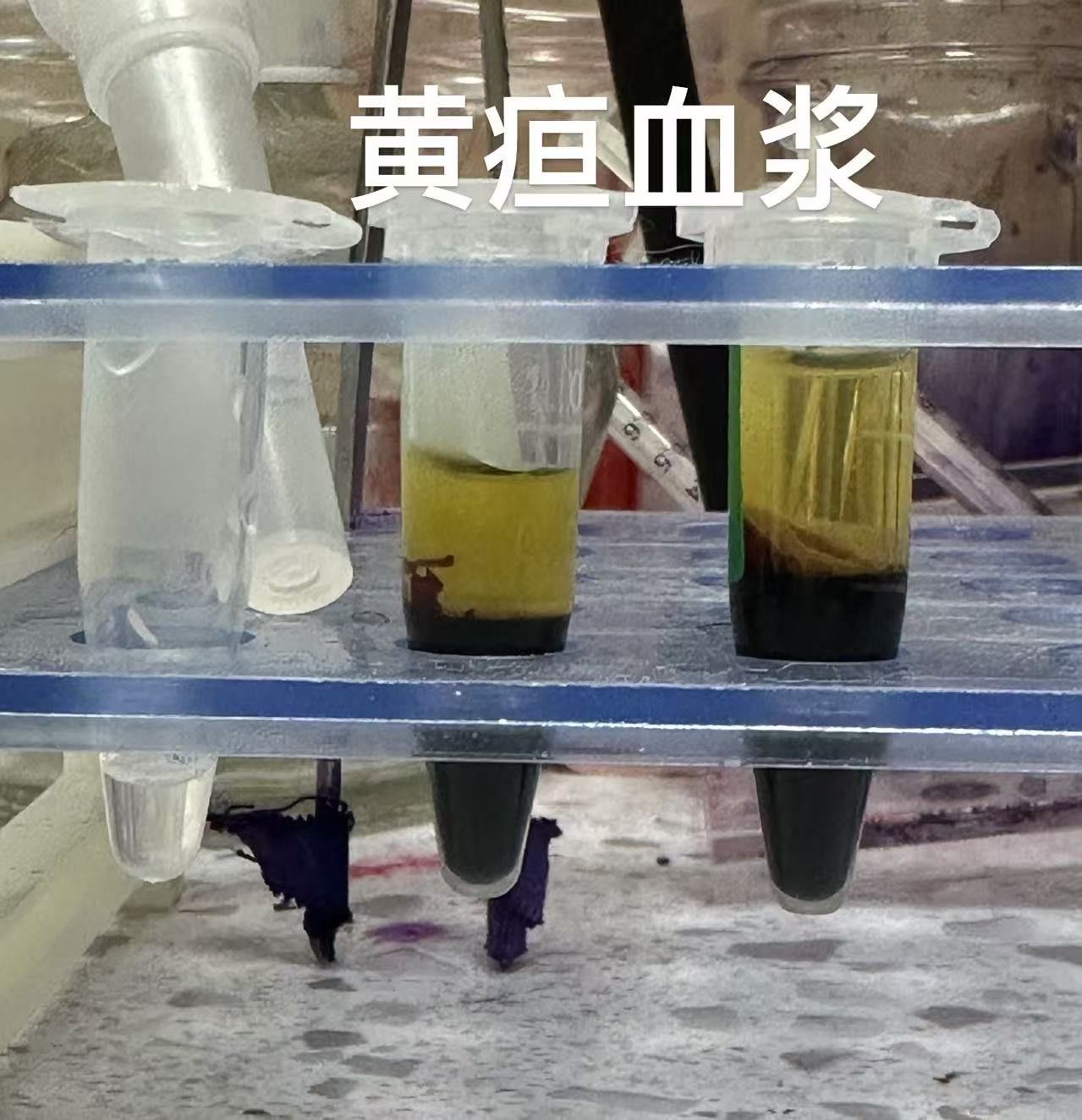 同样是来体检的猫咪🐱🐱,一个是白色血浆,一个是黄色血浆