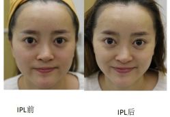 -丰联丽格医疗美容·联合丽格眼整形中心