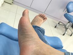 -世龙世家甲沟炎·灰指甲·嵌甲矫正·修脚(武侯区双楠店)