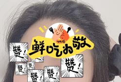 -大麦微针植发全国连锁