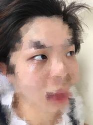 -美丽人生祛斑扁平疣汗管瘤中心