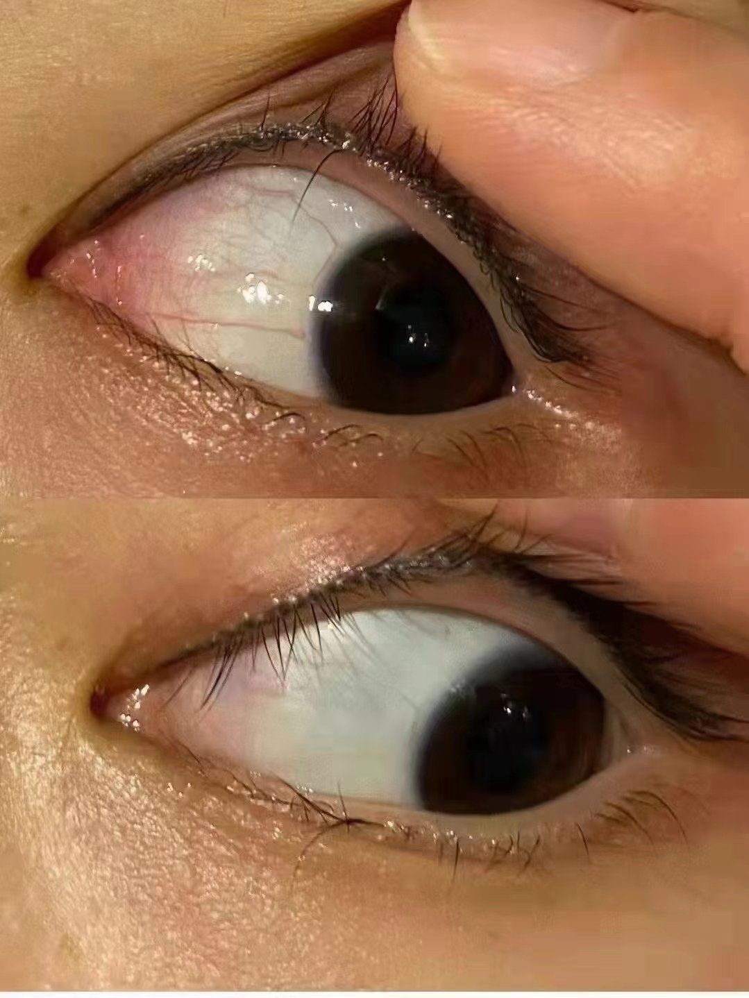 老人视力模糊 
青年视力不好
孩