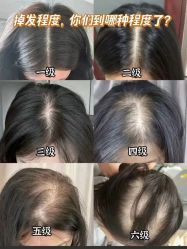 -希梵尔头皮抗衰·科技养发