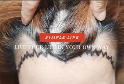 -大麦微针植发全国连锁