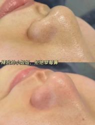 -春田皮肤管理中心品牌旗舰店