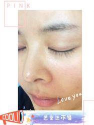 -广州健丽·去眼袋医疗美容机构