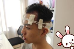 -大麦微针植发丨全国连锁