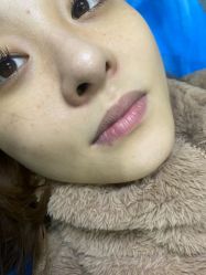 点击看大图 体验前-重庆联合丽格第五医疗美容医院