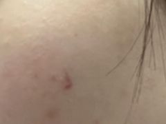-理療君·古法推拿•姜疗•SPA馆(东门店)