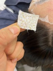 -瑶芳清颜草本祛痘