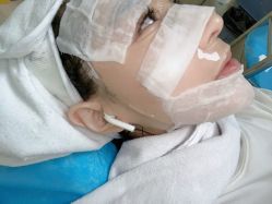 -北京叶子整形美容医院