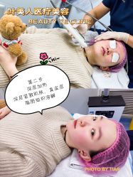 体验前-叶美人医疗美容