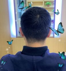 -大麦微针植发丨全国连锁