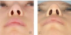 -CMS西美斯·美式医疗美容