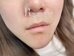 -RC半永久纹眉纹发际线