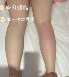 -Lily纤美·科技减脂中心