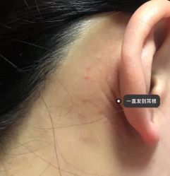 -一美医疗美容