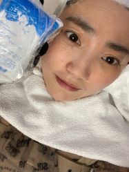 体验后-澳玛·星光医疗美容