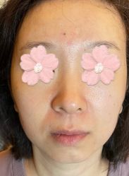 -Yestar 嘉兴艺星医疗美容医院