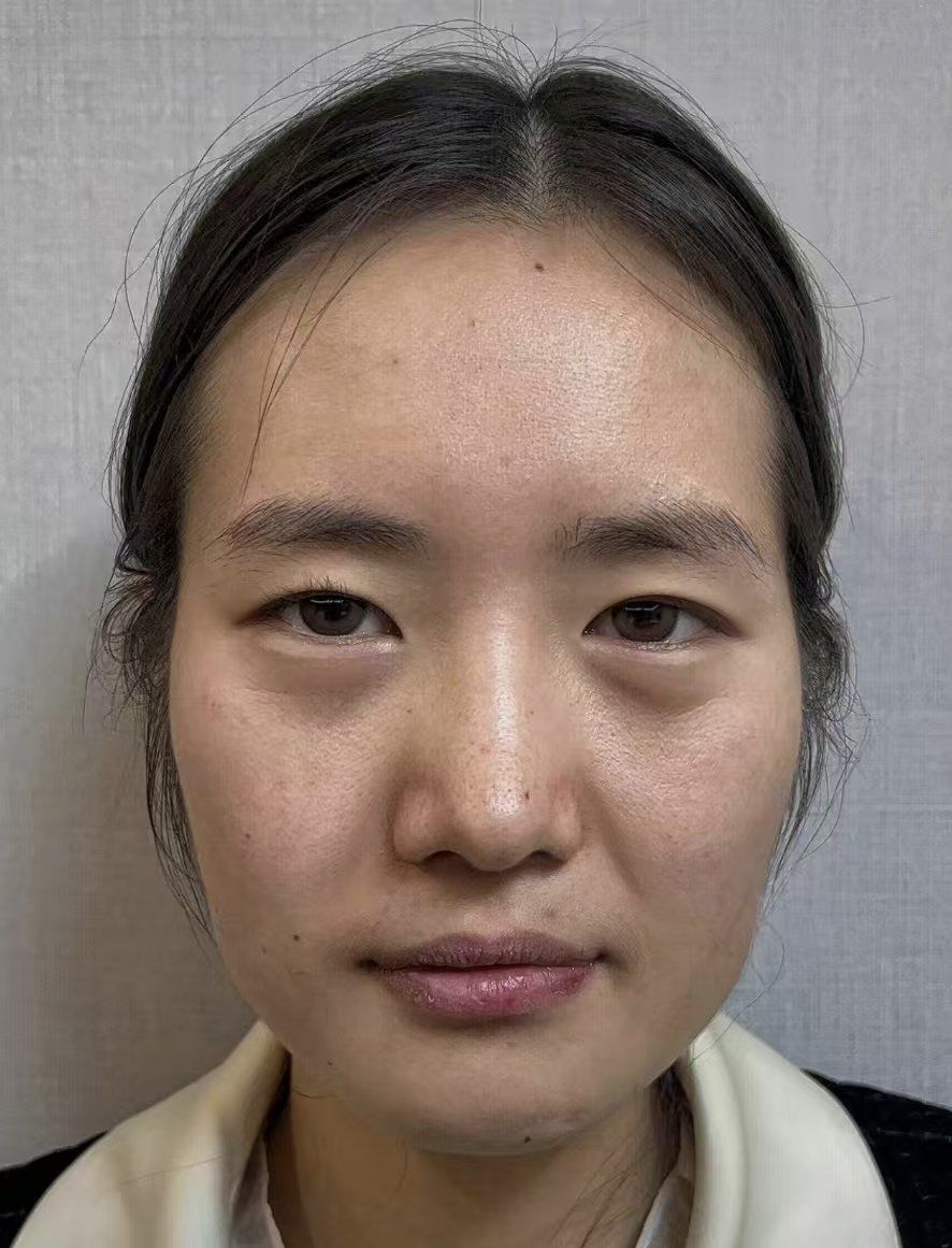 皱纹消失,瞬间年轻10岁