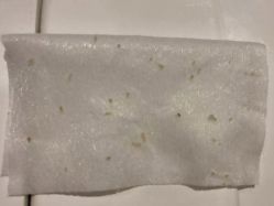 -苑苑vbeauty科技美容SPA