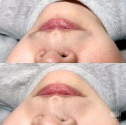 -薇兰专业脱毛连锁机构