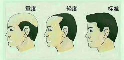 -博士园养发馆