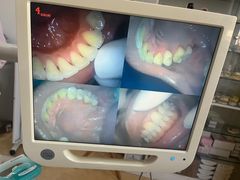 -赫尔森口腔·牙齿种植修复