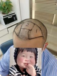 -大麦微针植发丨全国连锁