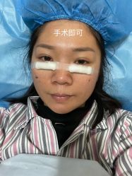 体验后-广州健丽·去眼袋医疗美容机构